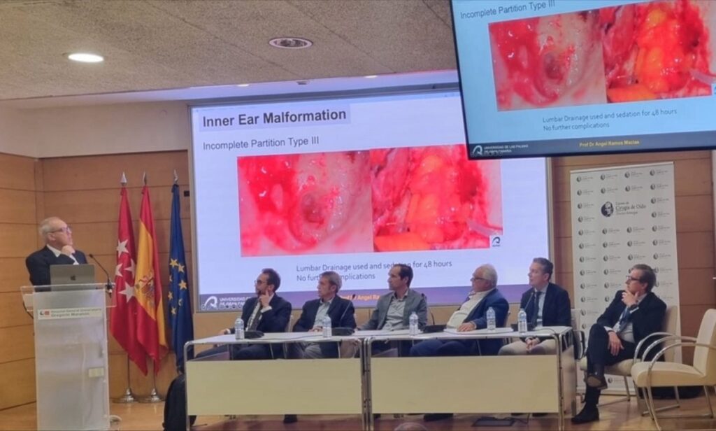 Complex cases in cochlear implantation - SurgSchool