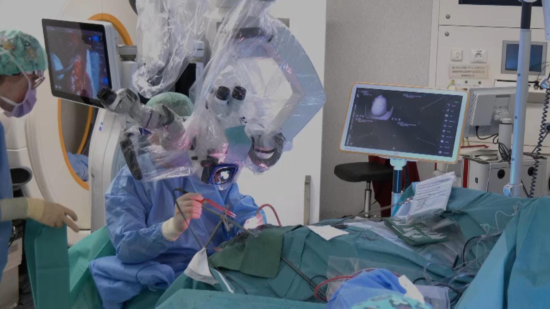 schwannoma trigeminal