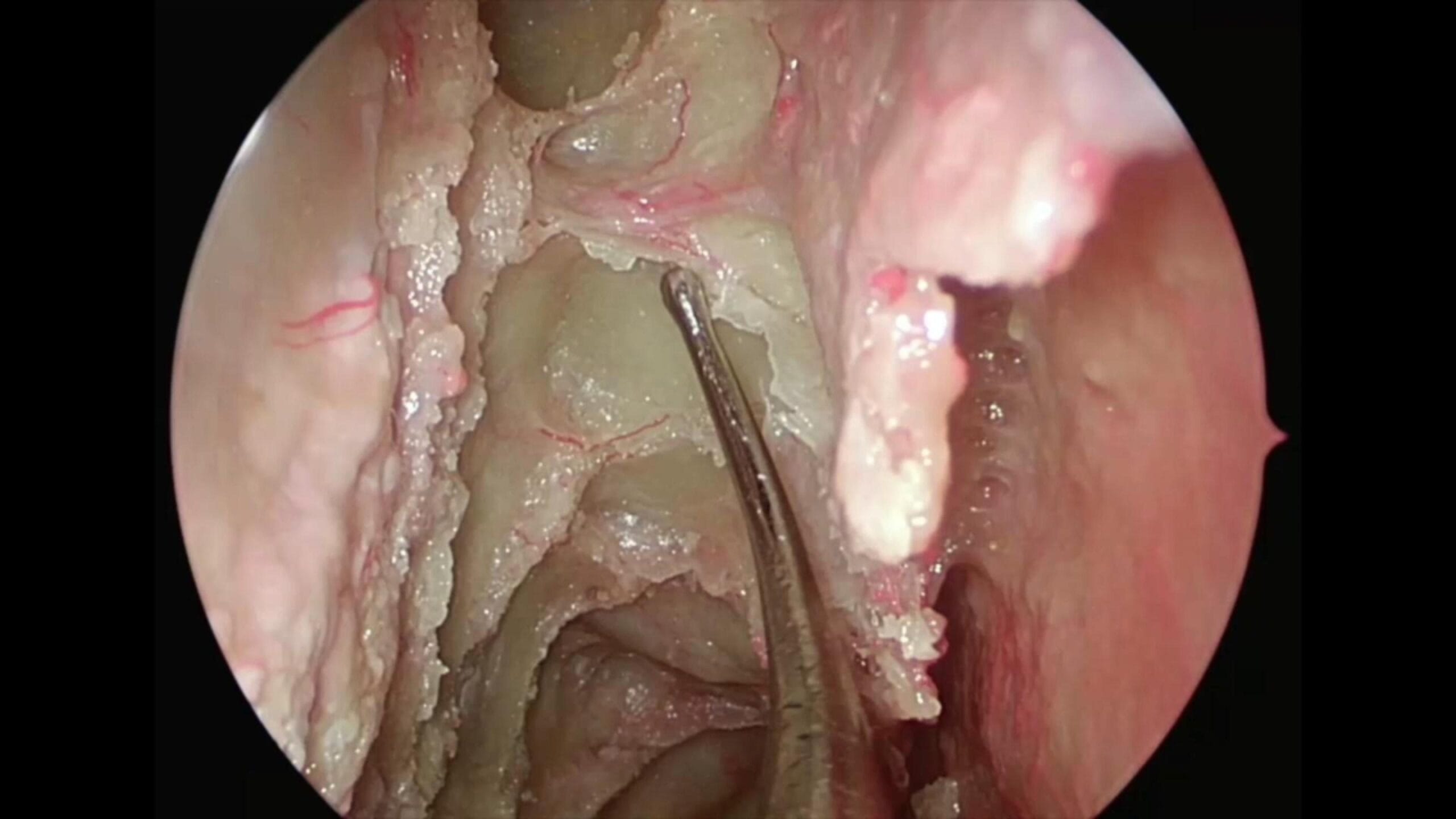 Anatomía Disección CENS