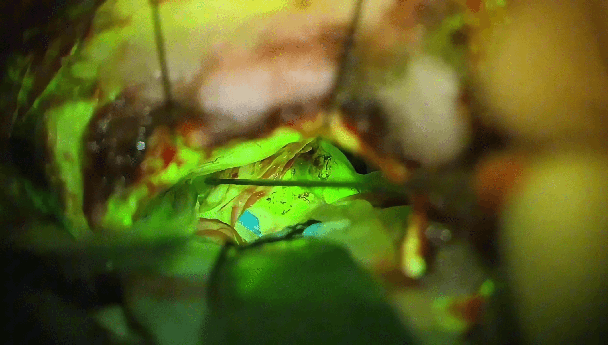 Schwannoma vestibular Koos III