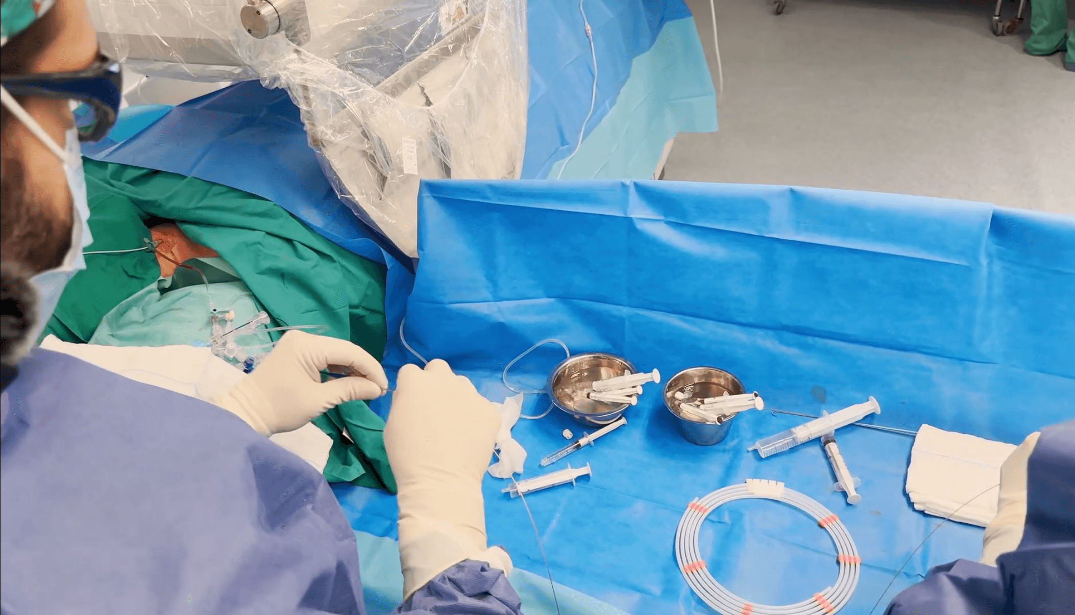 Embolización de varices pélvicas