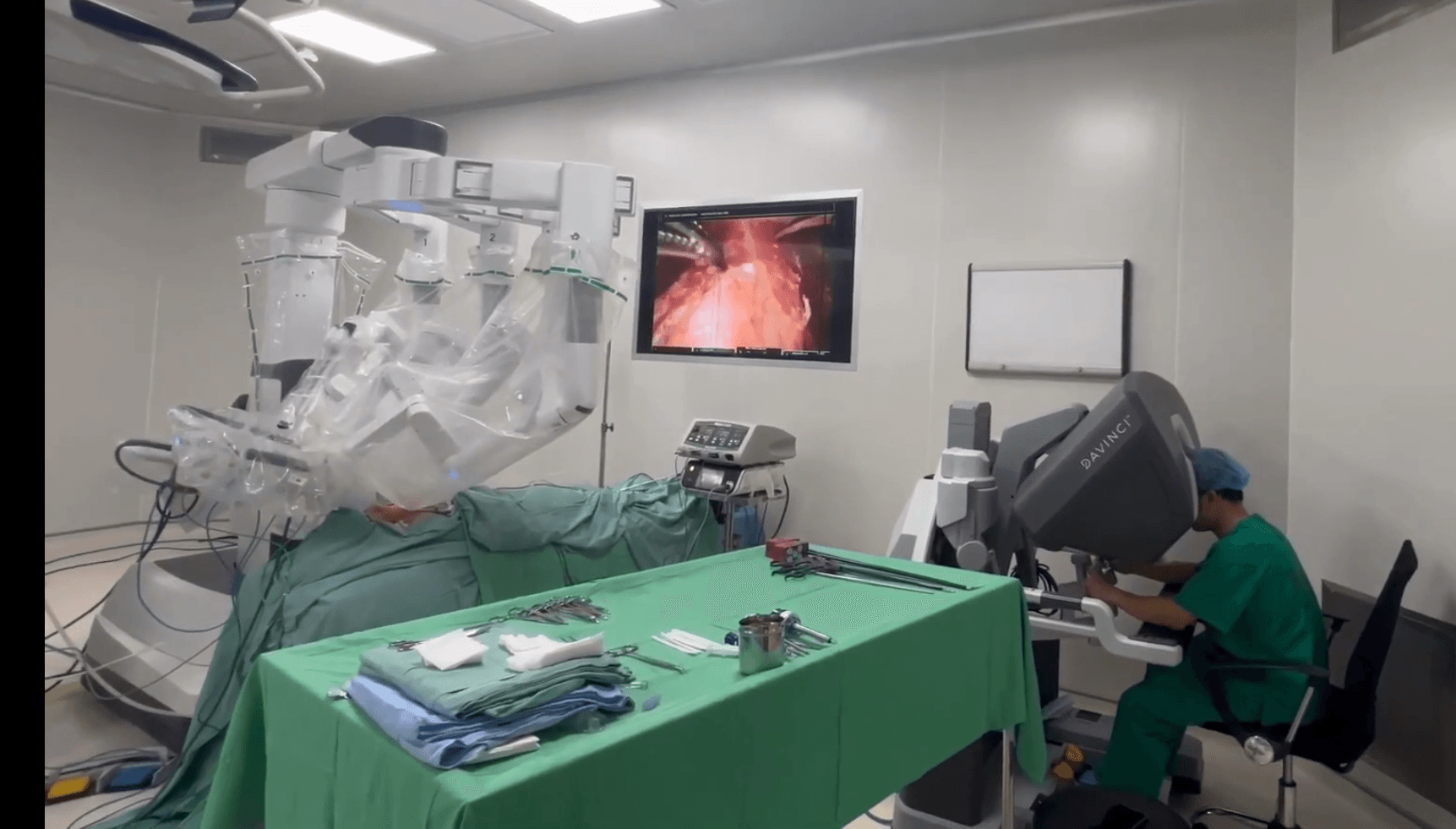 Tiroidectomía robótica transoral con verde de indocianina